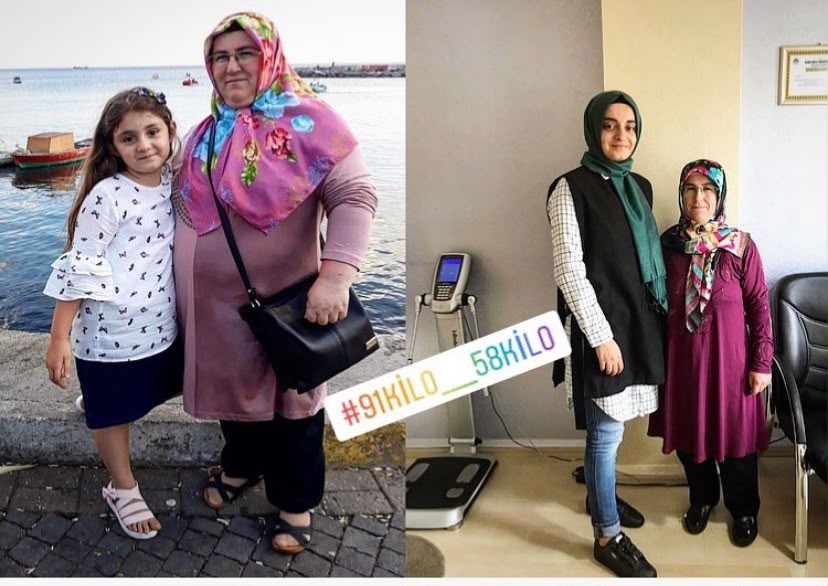 Hafifliyoruz 🎈
