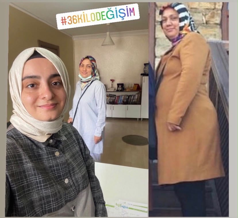 36 Kiloluk İnanılmaz Değişim 👗