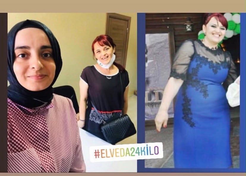 Kalıcı ve Sağlıklı İncelme 🦋